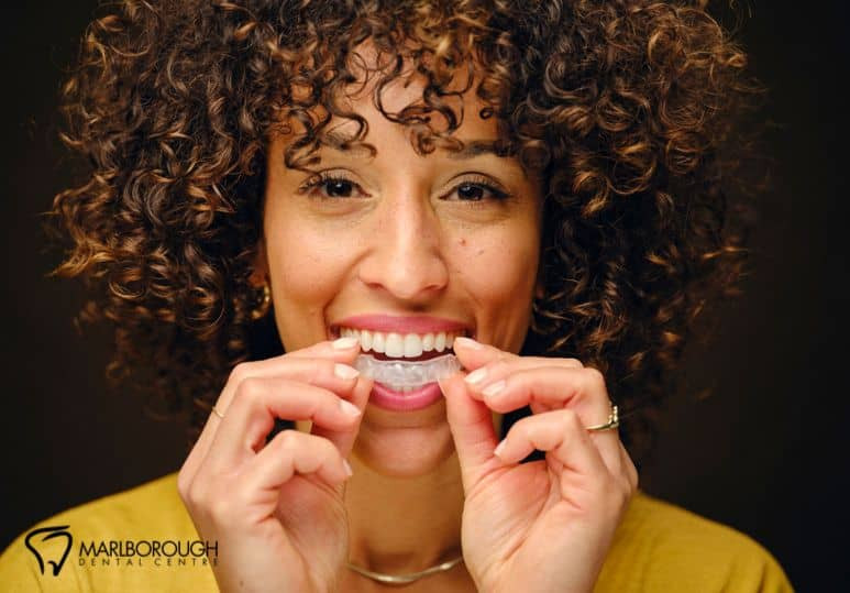 The Dos And Don'ts Of Invisalign®