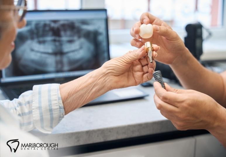 Missing Teeth? Here’s Why Dental Implants Are the Gold Standard