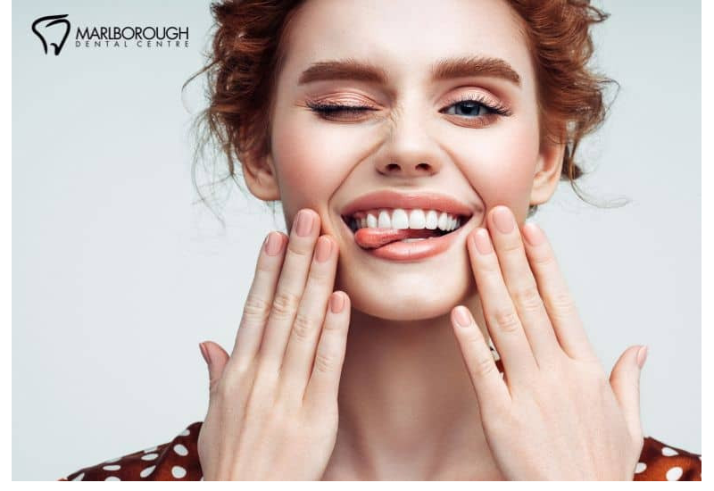 Keep Your Teeth Whiter After Treatment | Teeth Whitening Calgary 