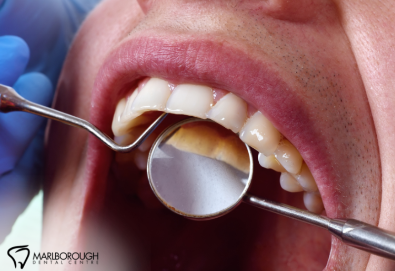 Skipping Your Dental Exam? Here’s Why It Could Cost You More Later 