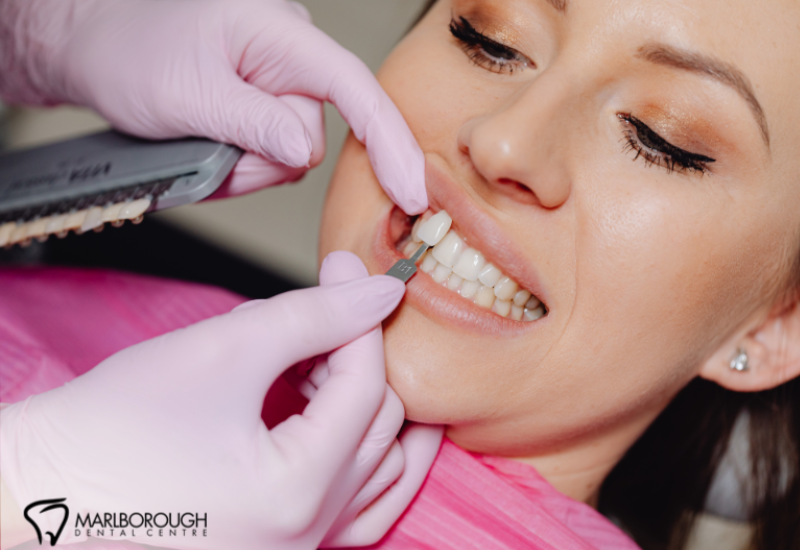 Veneers in Calgary: A Confident Smile Starts at Marlborough Dental Centre 