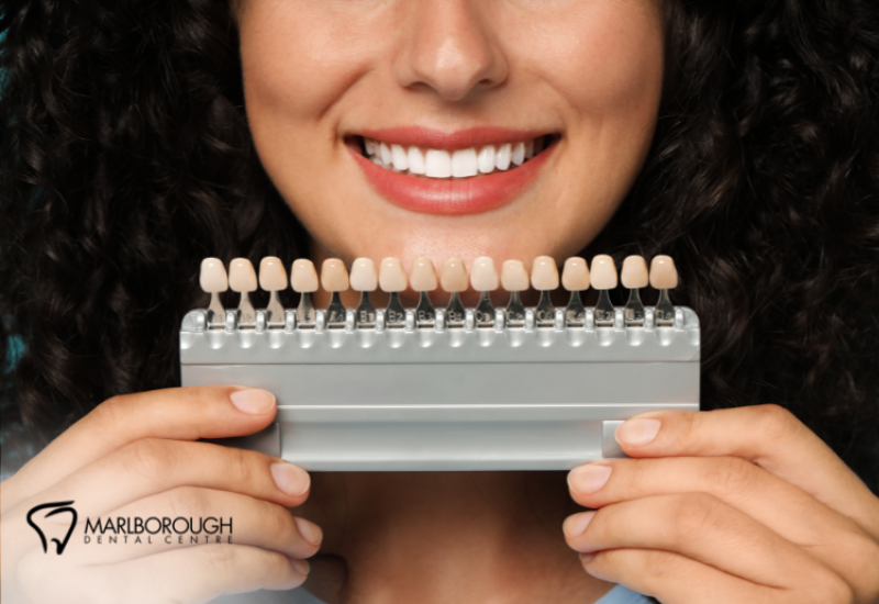 Veneers vs. Bonding: Cosmetic Solutions for Calgary Smiles 