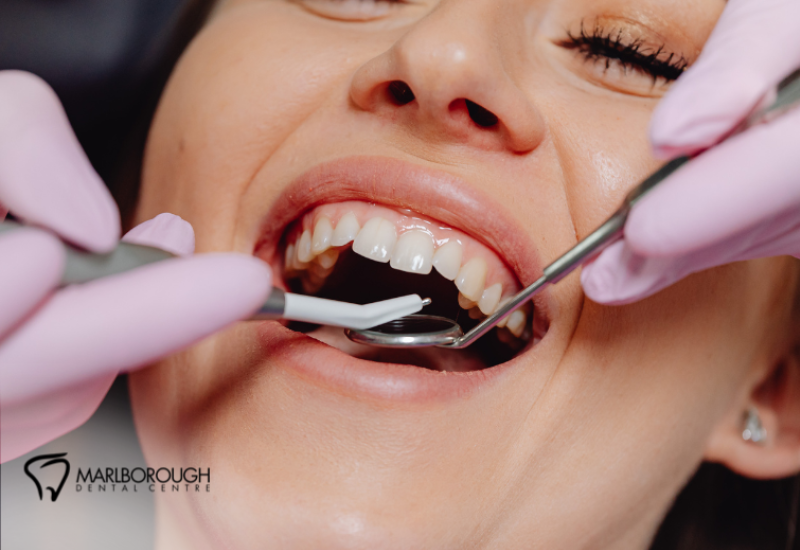 Preparing for Holiday Travel? Get a Dental Exam First Preparing for Holiday Travel? Get a Dental Exam First