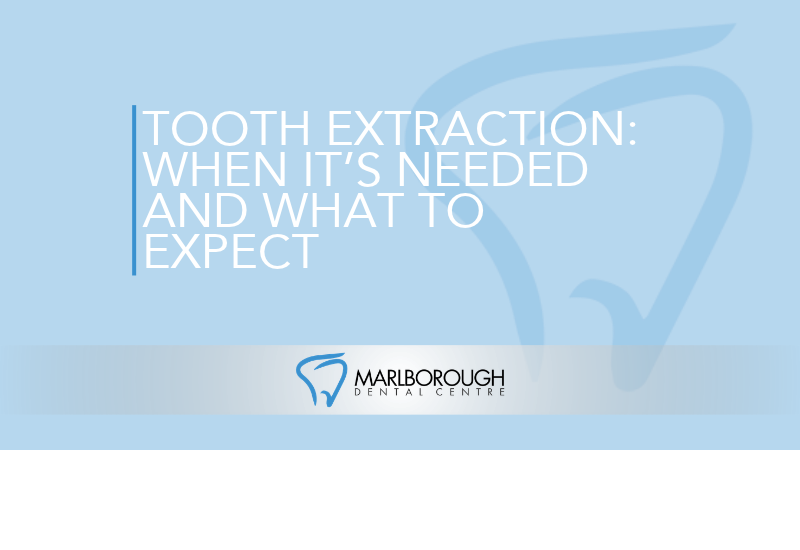 Tooth Extraction: When It’s Needed and What to Expect