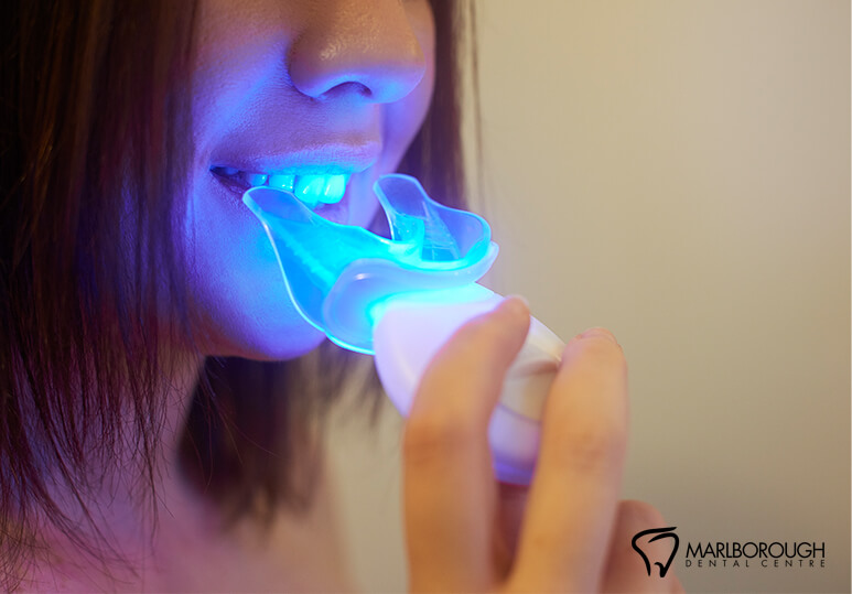 Teeth-Whitening Aftercare Tips