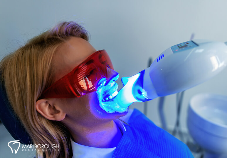 Did You Know? 5 Interesting Facts About Teeth Whitening.
