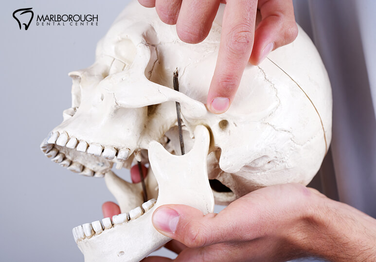Understanding the Difference Between TMJ And TMD