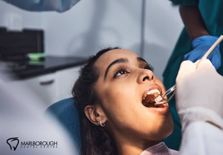 How Does Your Dentist Decide You Need A Root Canal?