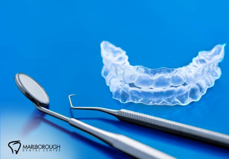 Veneers vs Invisalign®: Which Is Right For Me?
