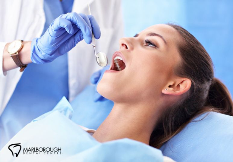 What Happens During Root Canal Treatment?