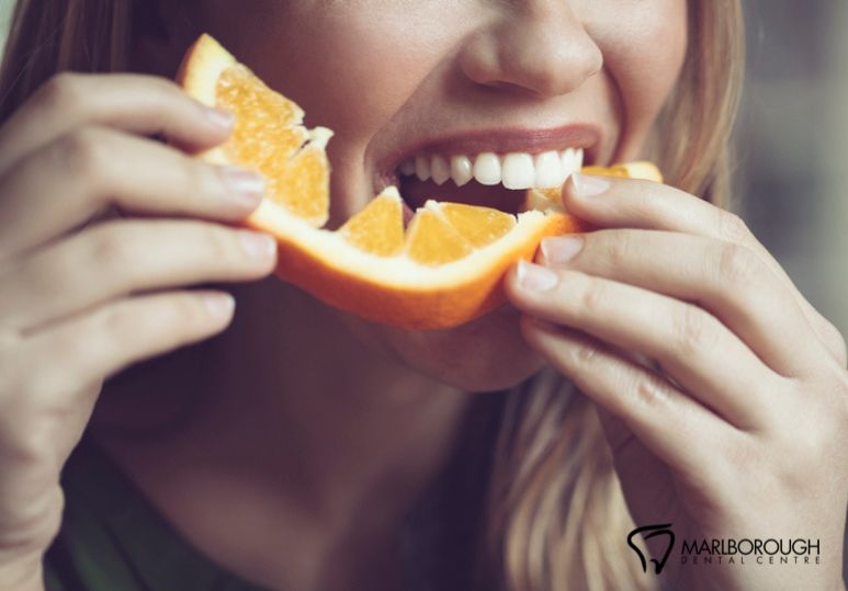 Foods To Avoid After Teeth Whitening Treatment