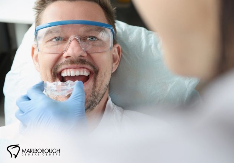 Custom Sports Mouthguards vs. Store-Bought: What’s the Difference?