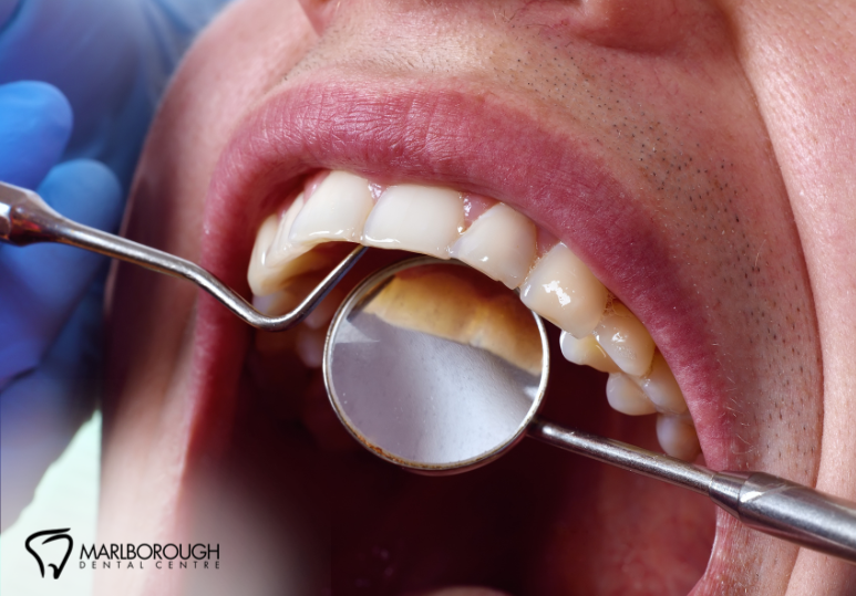 Skipping Your Dental Exam? Here’s Why It Could Cost You More Later 