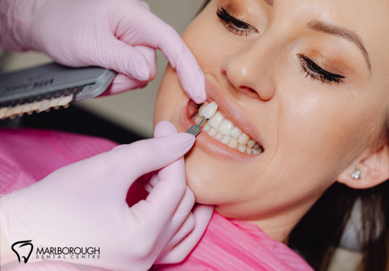 Veneers in Calgary: A Confident Smile Starts at Marlborough Dental Centre 