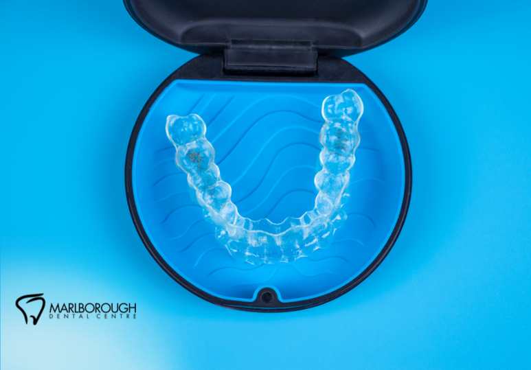 Invisalign vs. Braces: What’s Best for NE Calgary Teens? 