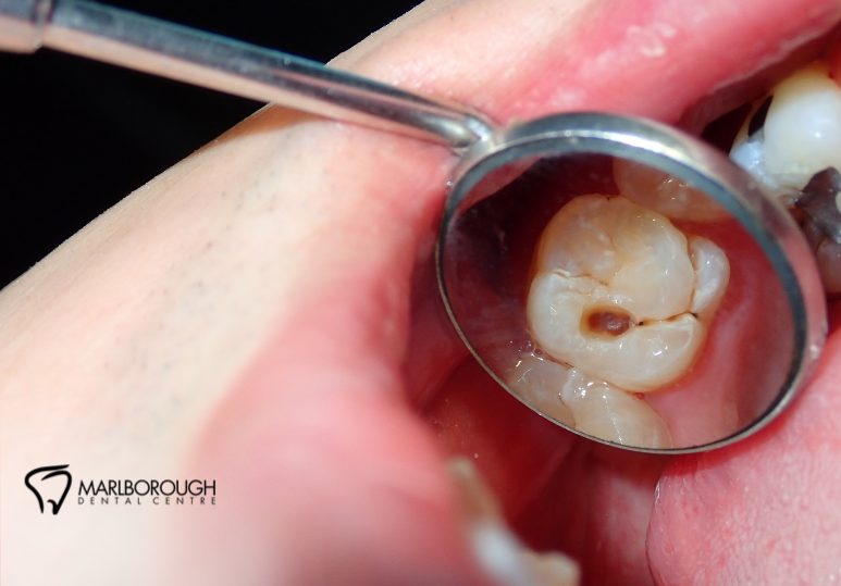 Emergency Dentist in NE Calgary: When to Call and What to Expect 