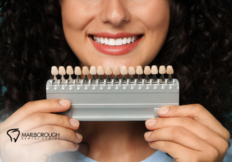 Veneers vs. Bonding: Cosmetic Solutions for Calgary Smiles 