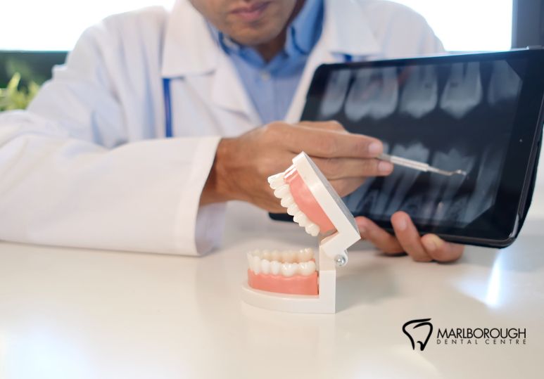 What Is Restorative Dentistry? Common Treatments Explained