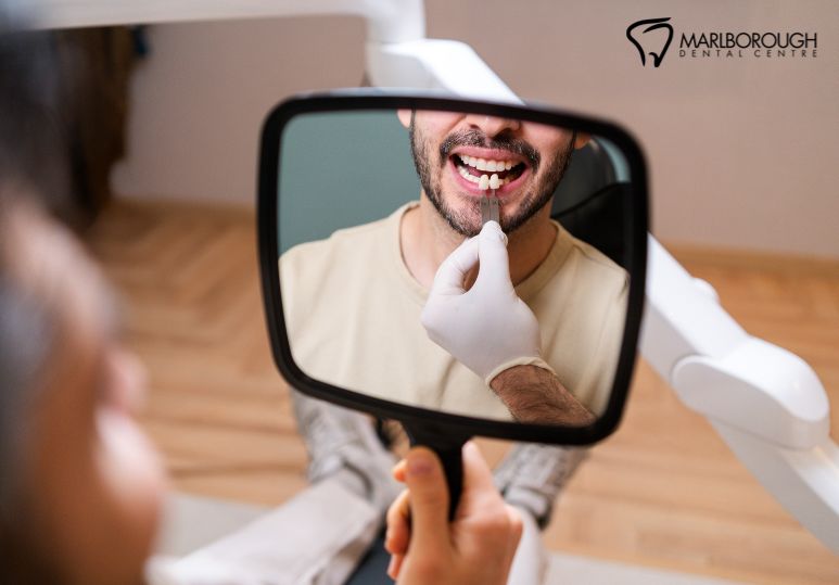  How Long Do Dental Crowns Last?