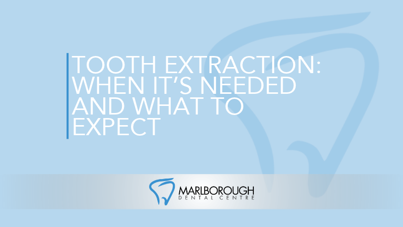 Tooth Extraction: When It’s Needed and What to Expect
